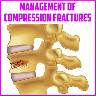 What is Fracture in Physical Education and Its Unexpected Link to Athletic Motivation?